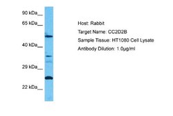 CC2D2B Antibody, Novus Biologicals 100 &mu;L; Unconjugated:Antibodies,
